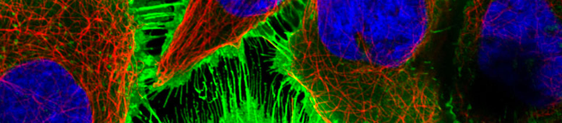 EGFR-protein-strip-4